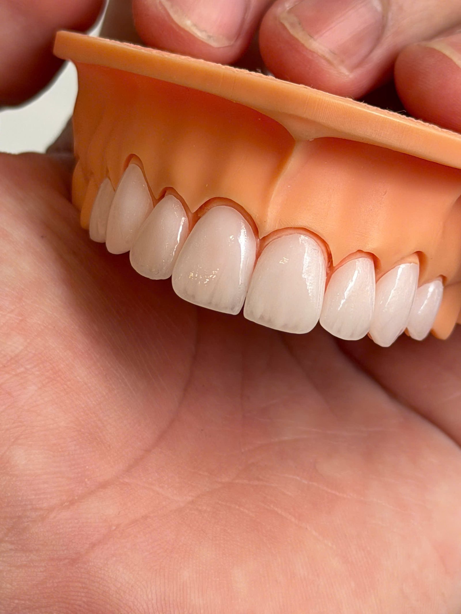 Hình ảnh sản phẩm Pro Dental Lab
