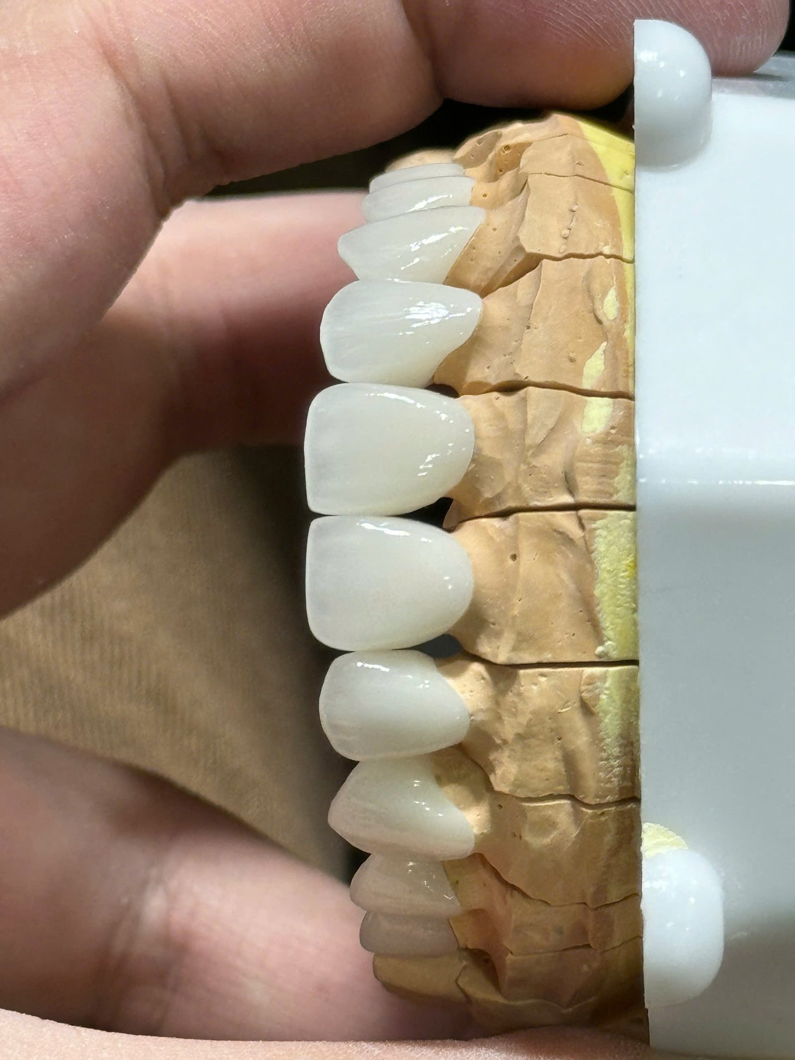 Hình ảnh sản phẩm Pro Dental Lab