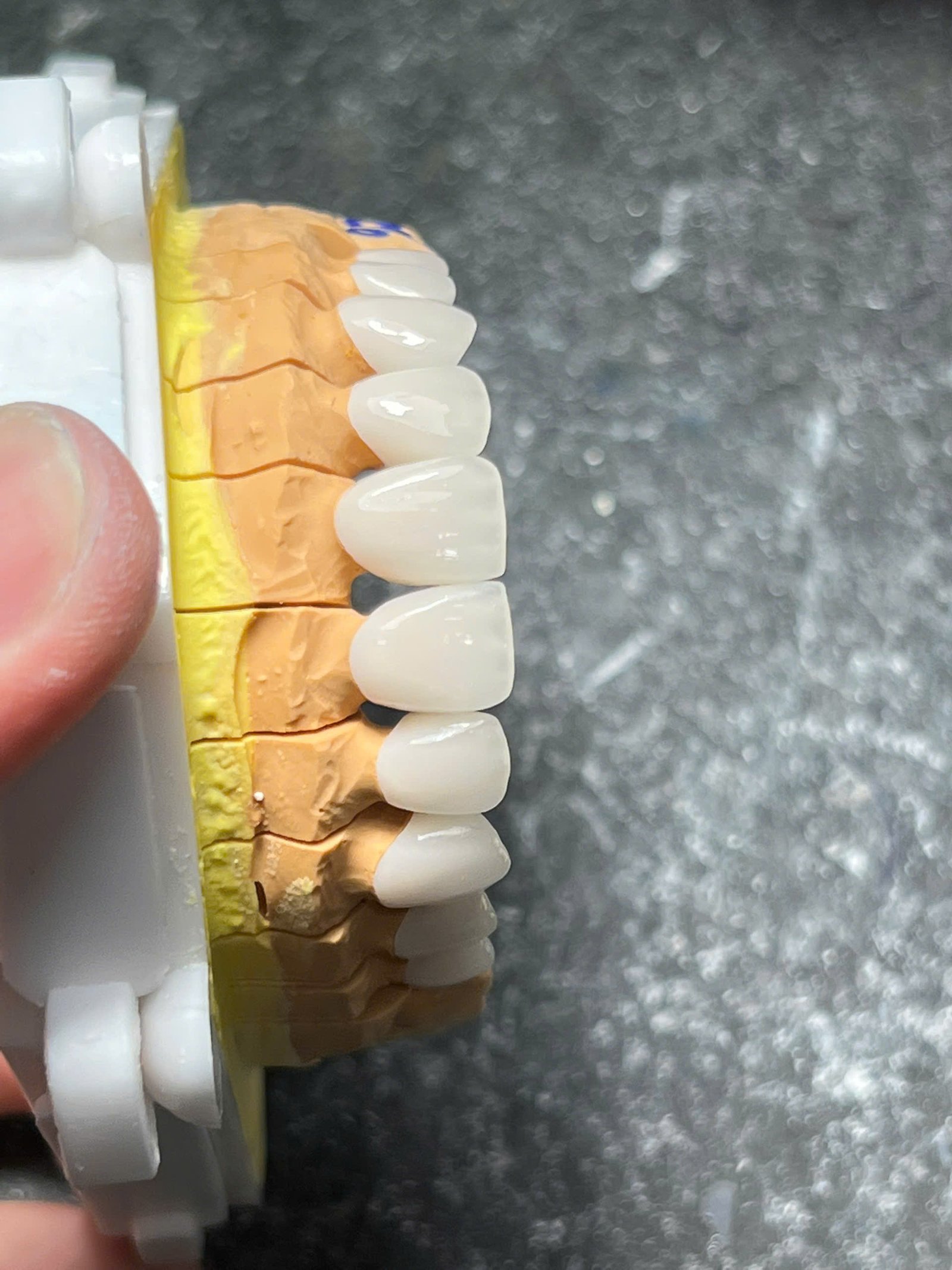 Hình ảnh sản phẩm Pro Dental Lab