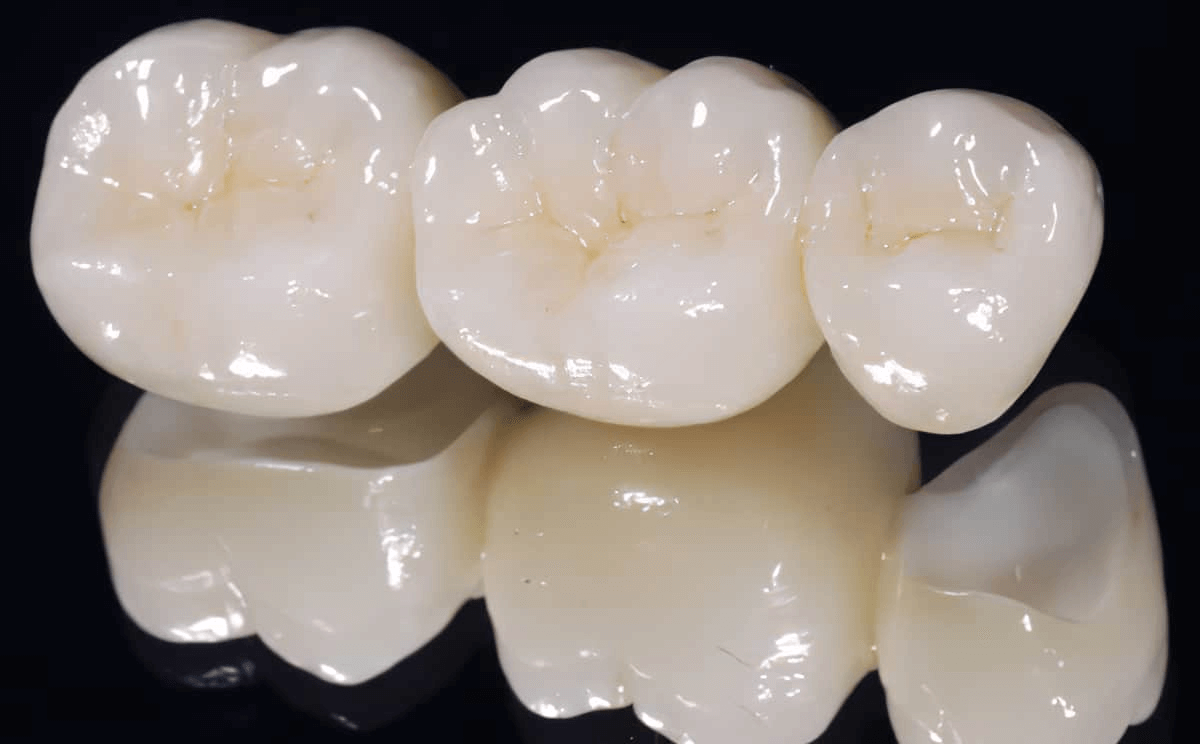 Răng sứ Zirconia